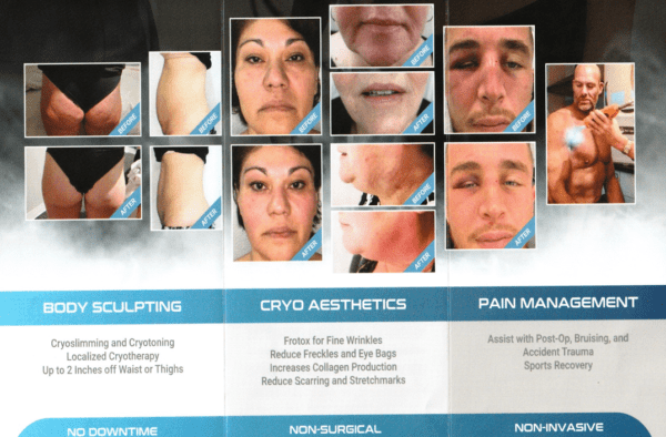 A woman 's face is shown with various treatments.